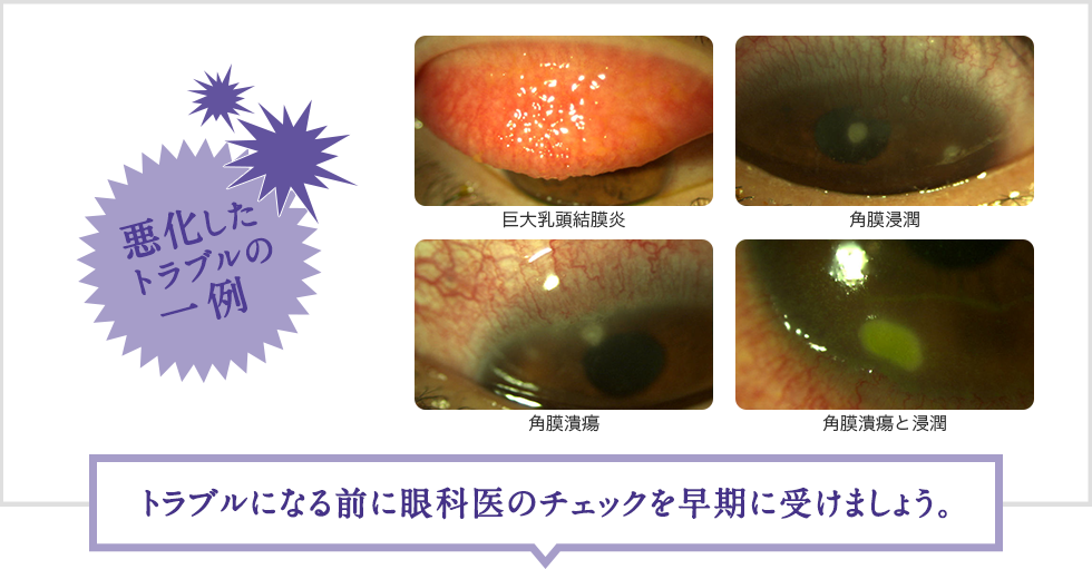 トラブルになる前に眼科医のチェックを早期に受けましょう。